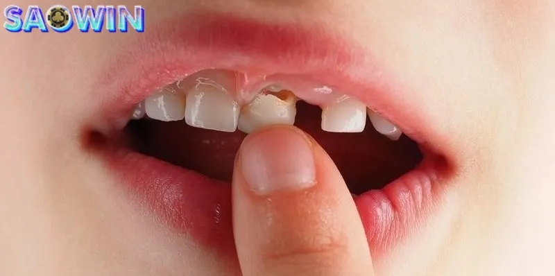 Mơ rụng răng không chảy máu đánh 08, 80